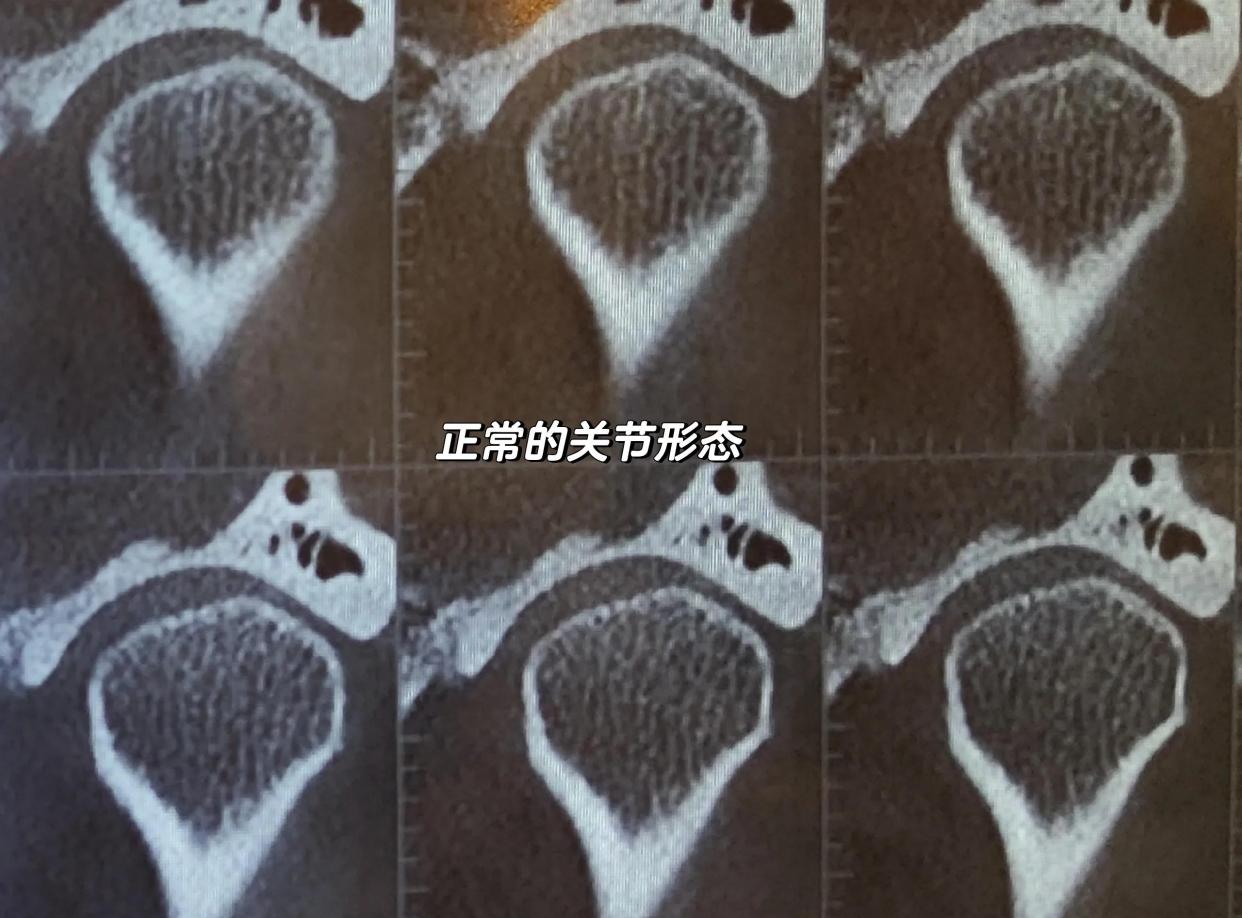 🦴髁骨位置大揭秘！