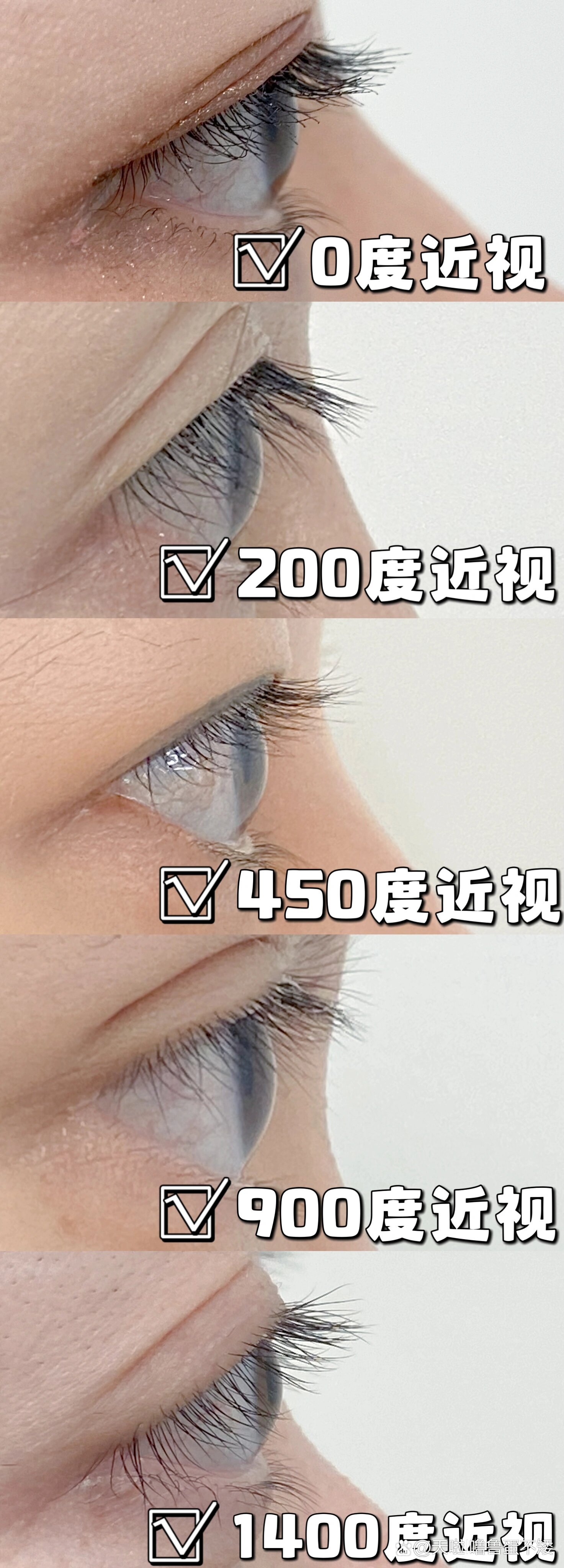 2500度近视图片