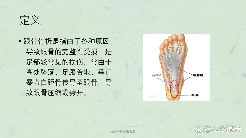 p 跟骨骨折 br  解剖 跟骨骨折 是由于外力创伤等因素导致足跟处