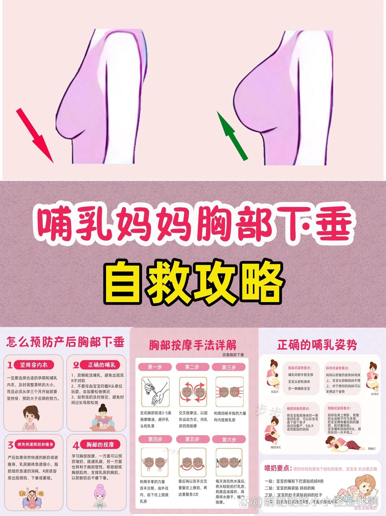 孕期哺乳期胸部下垂自救指南