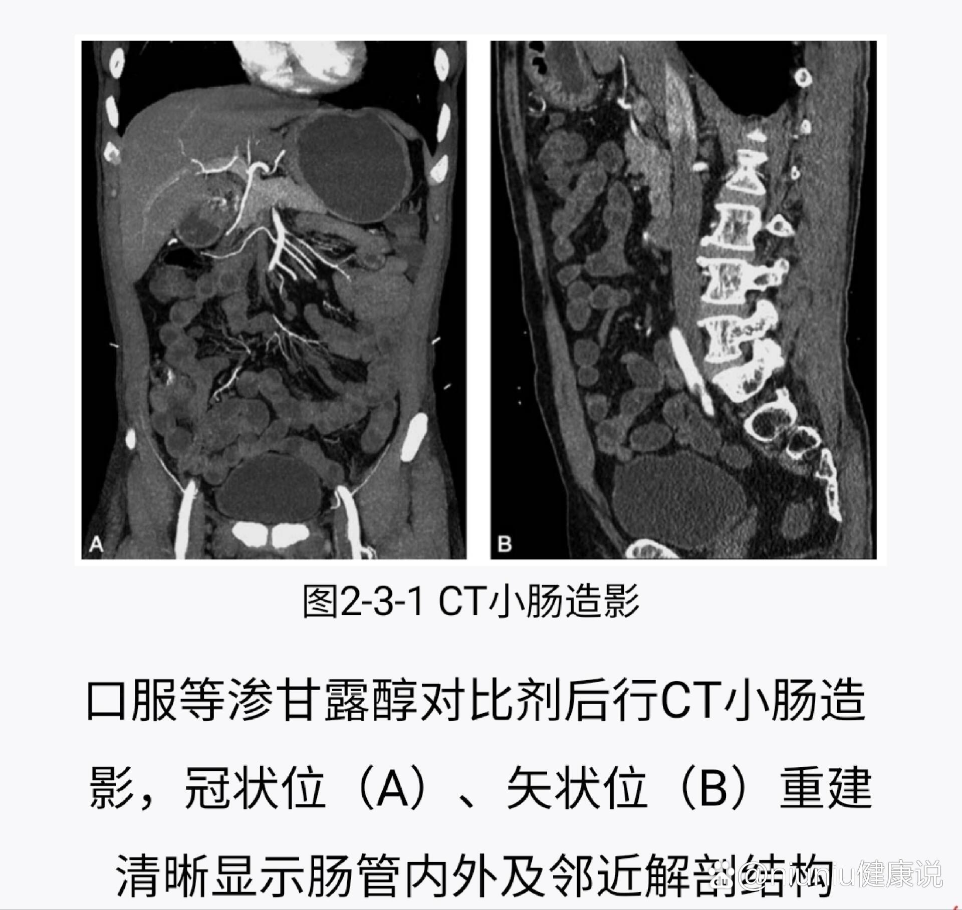 大肠小肠检查(大肠小肠检查都没有问题为什么右腹老瘾痛和胀痛)