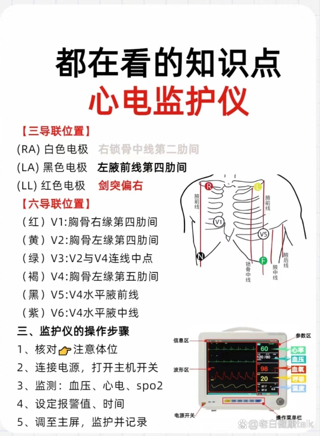 心电监护仪位置图图片