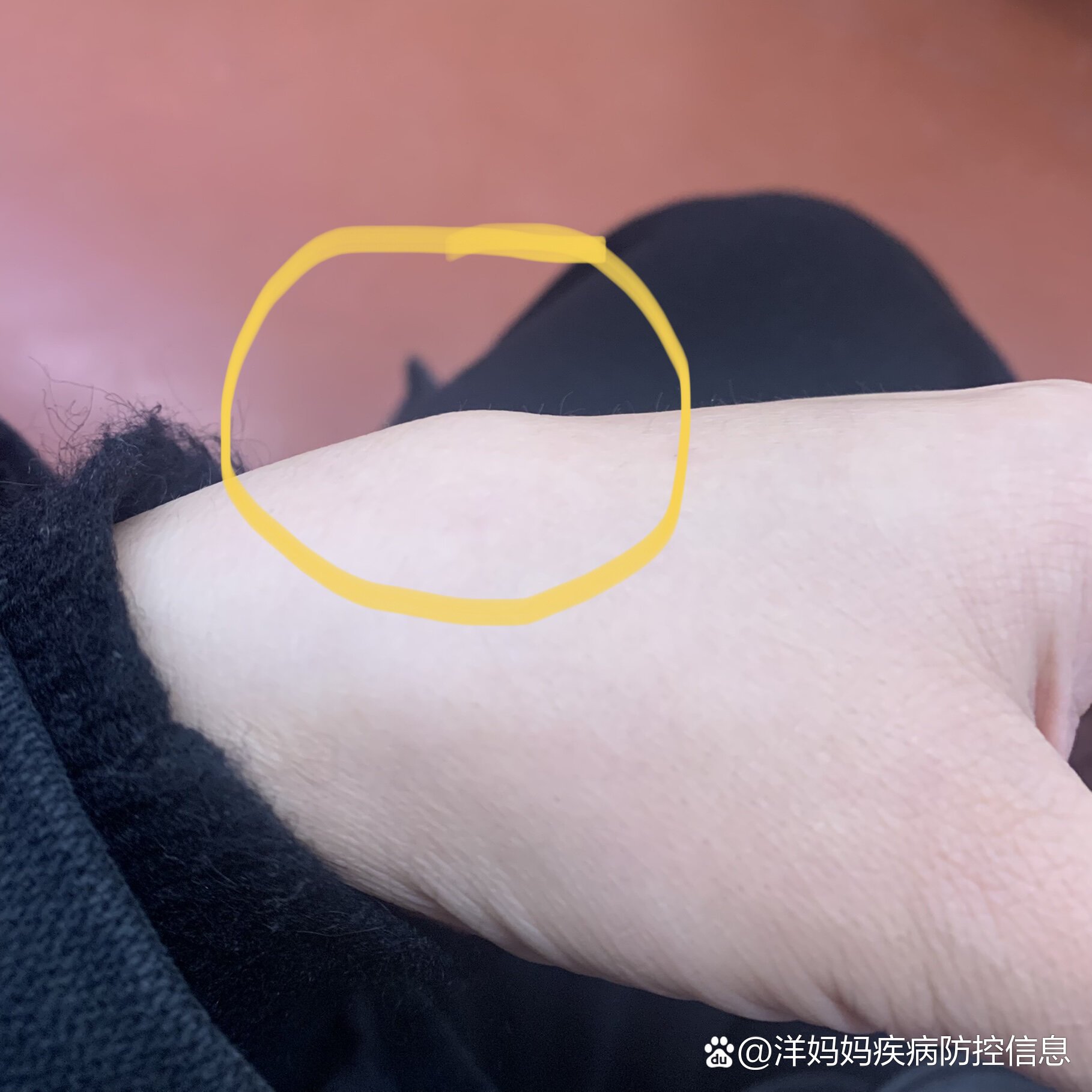 手背上莫名其妙凸起一块骨头04