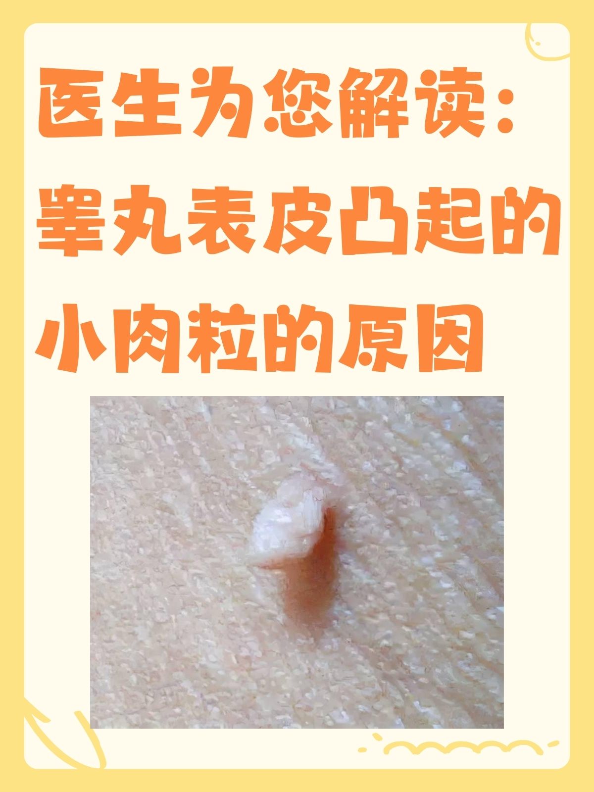 有部分人的睾丸表皮上面会出现凸起的小肉粒😣,摸上去像小小的疙瘩