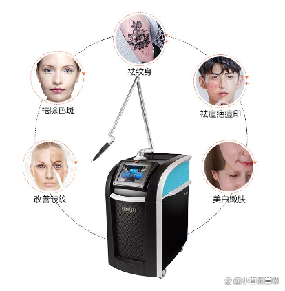 皮秒和光子嫩肤都能祛斑,有何区别?皮秒的适应症有哪些?