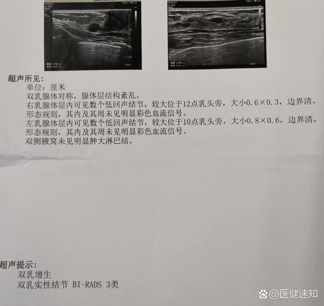 北京东直门中医院、全国服务-收费透明号贩子挂号联系方式，百分百保证拿到号！的简单介绍