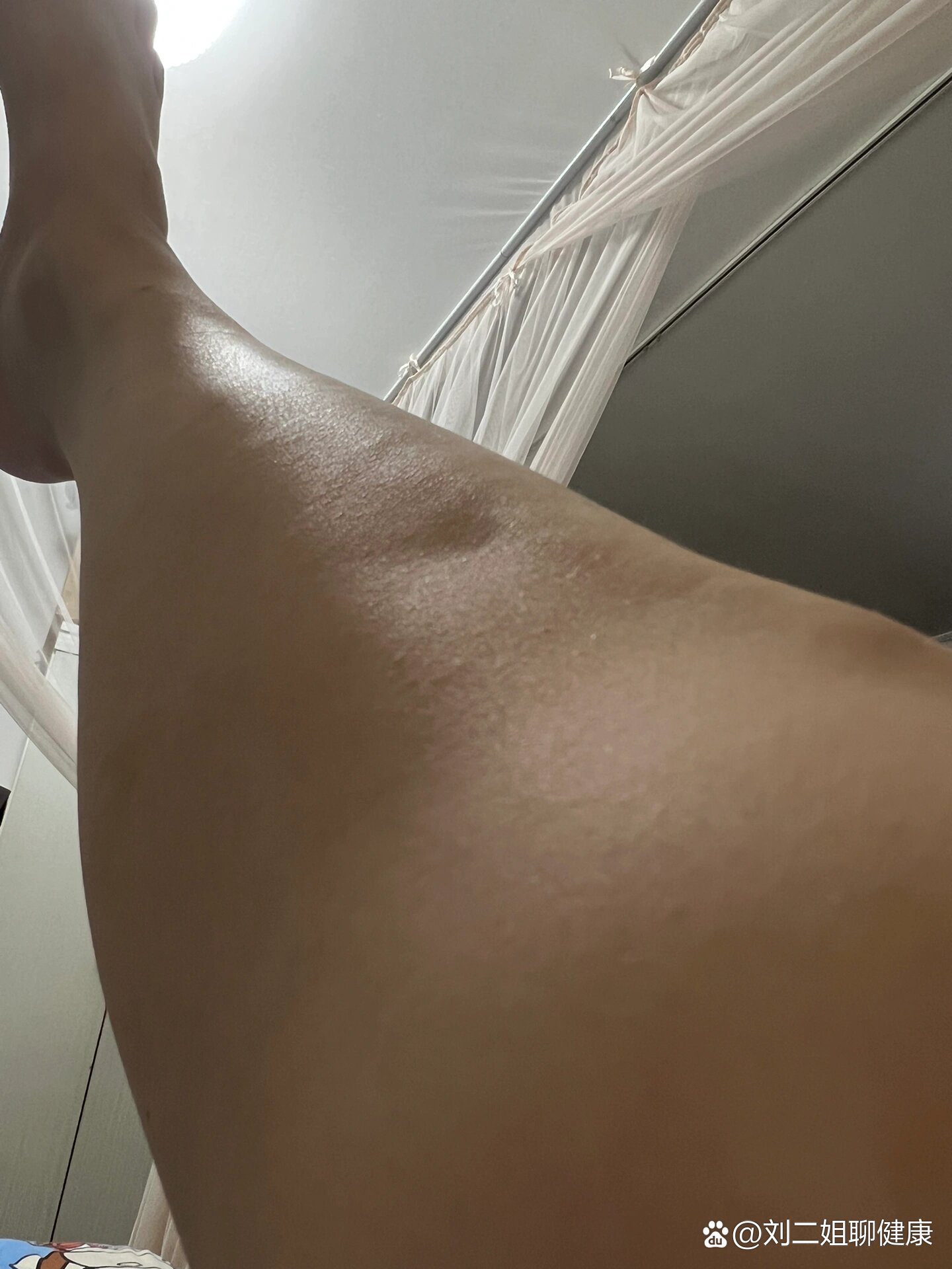  p>小腿上有个凹下去的坑 br>小腿前面的骨头有个凹洞,今天突然发现的