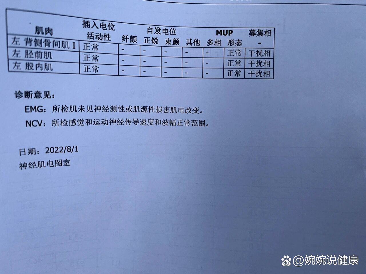 面神经肌电图结果解读图片