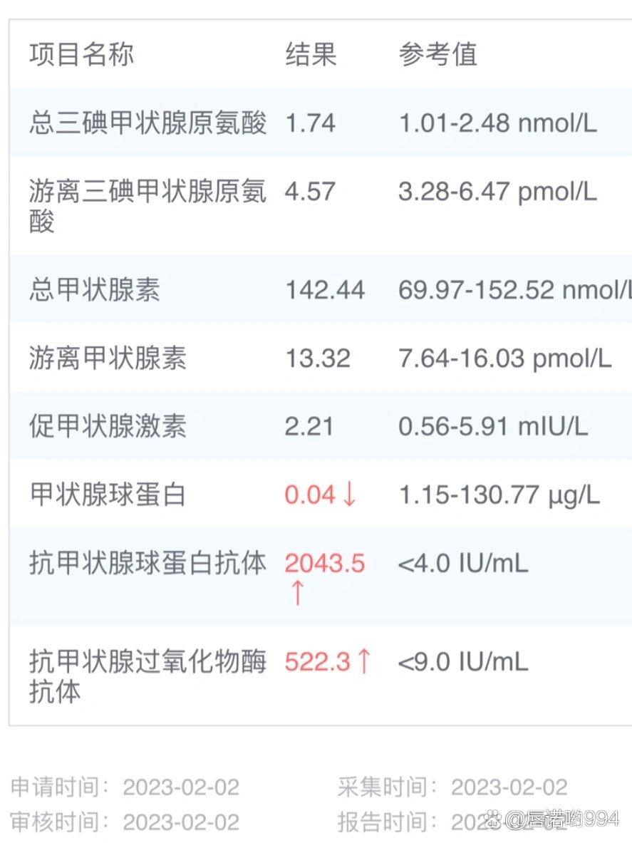 游离甲状腺素偏高图片