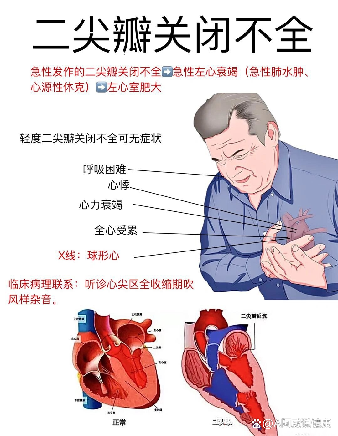 92医学笔记