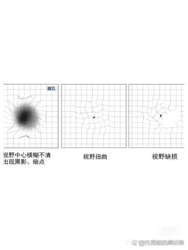 盯着看15秒的图图片