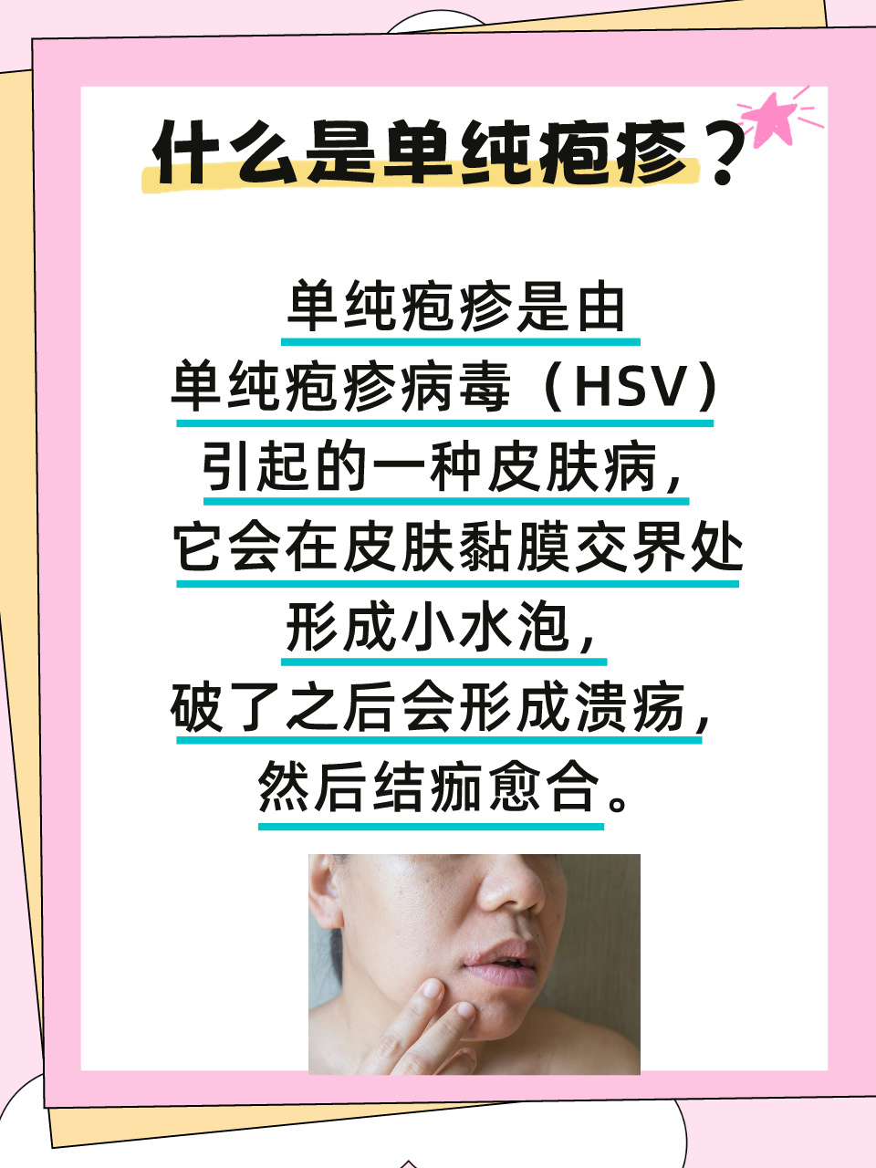反复单纯疱疹:日常护理与治疗方案!