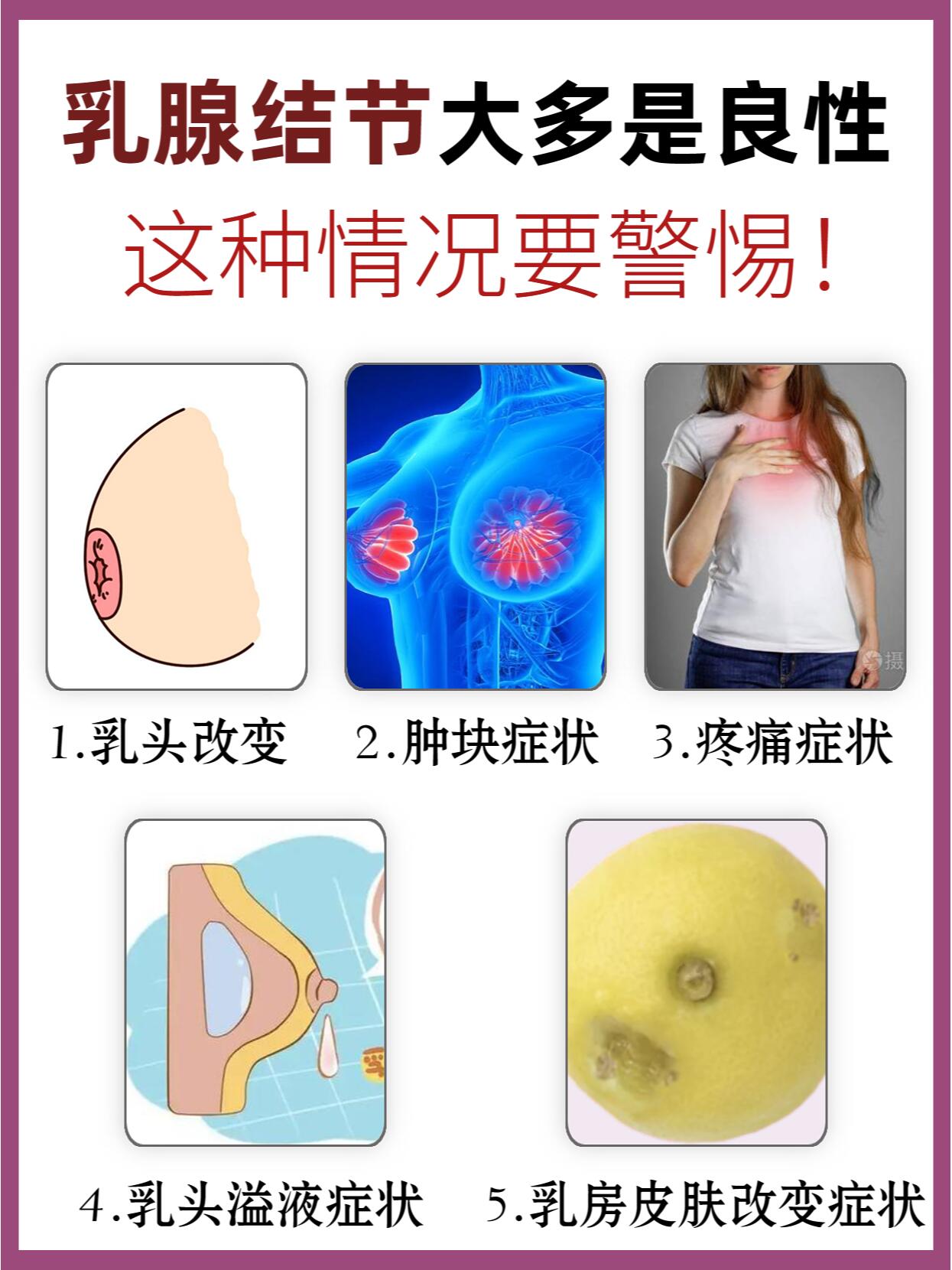 乳腺结节症状图片