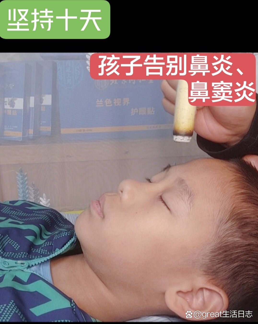 孩子告别慢性鼻炎77鼻窦炎【艾灸调理】