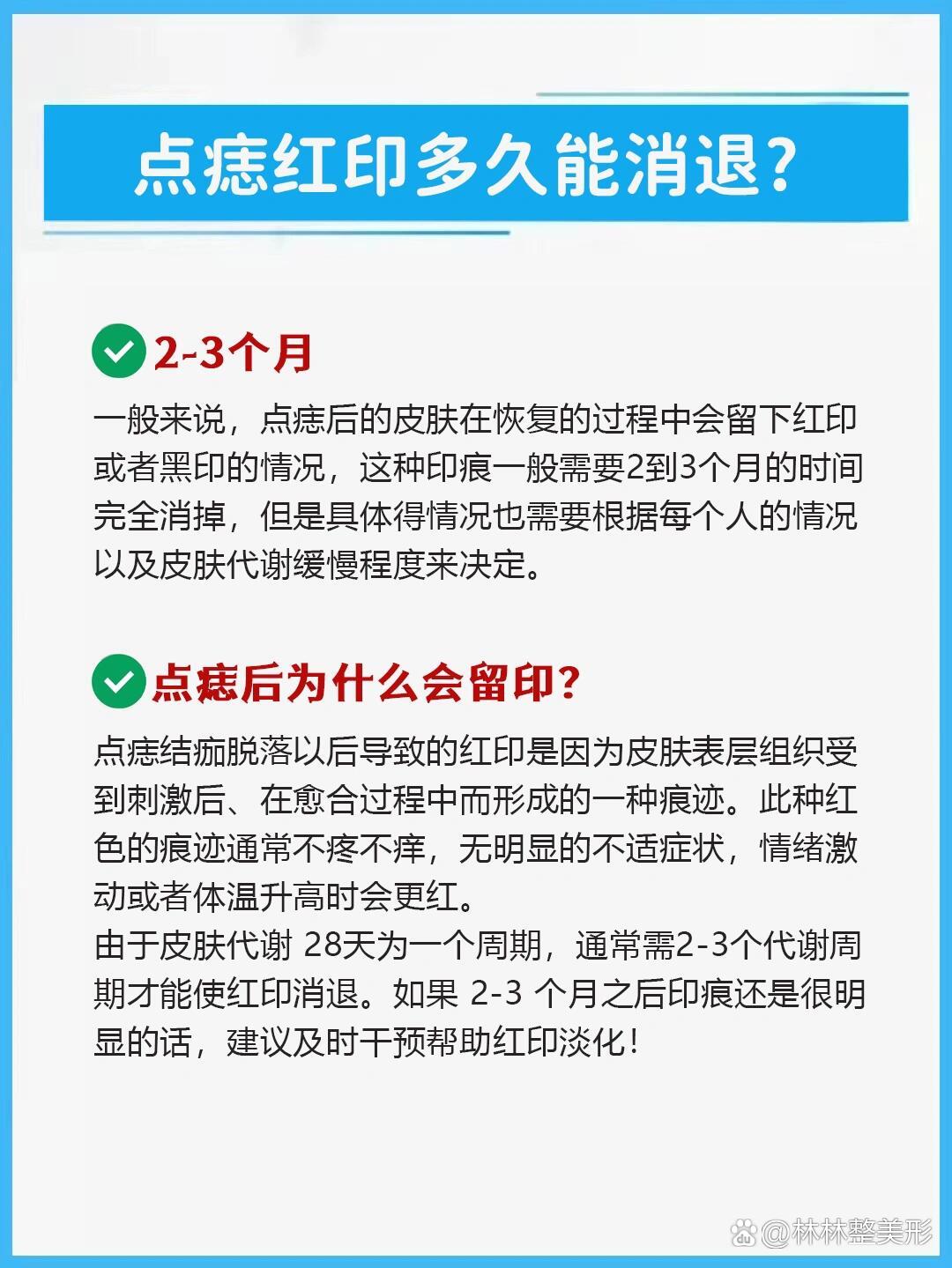 点痣红印多久能消退(内附快速去红印方法)