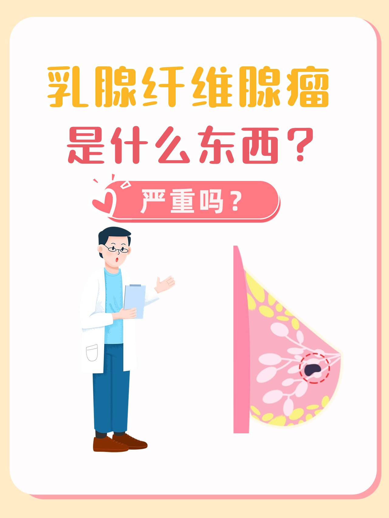 乳腺纤维瘤的位置图片图片