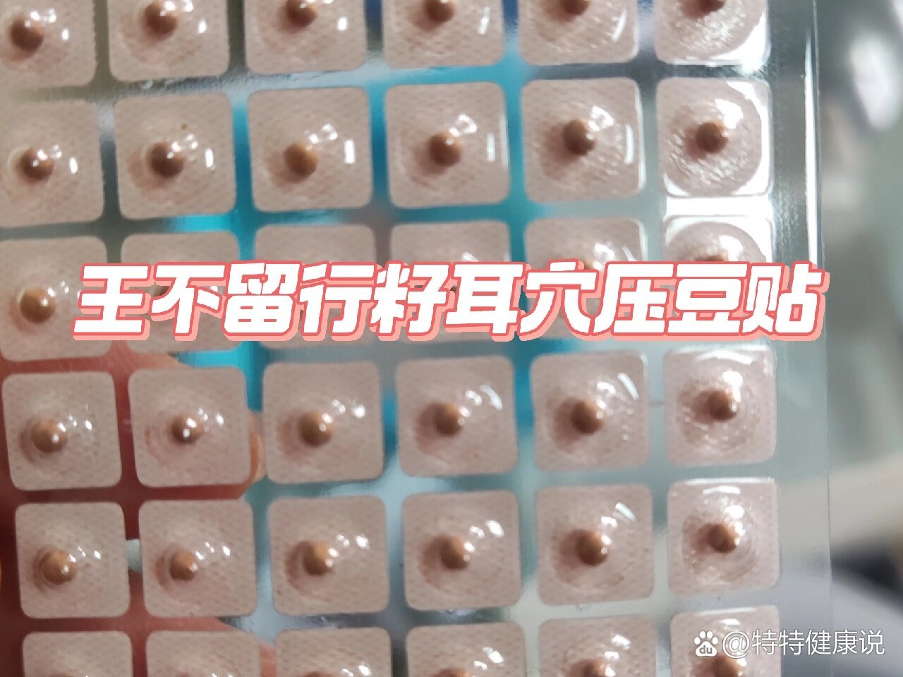 尝试一下:王不留行籽耳穴压豆贴