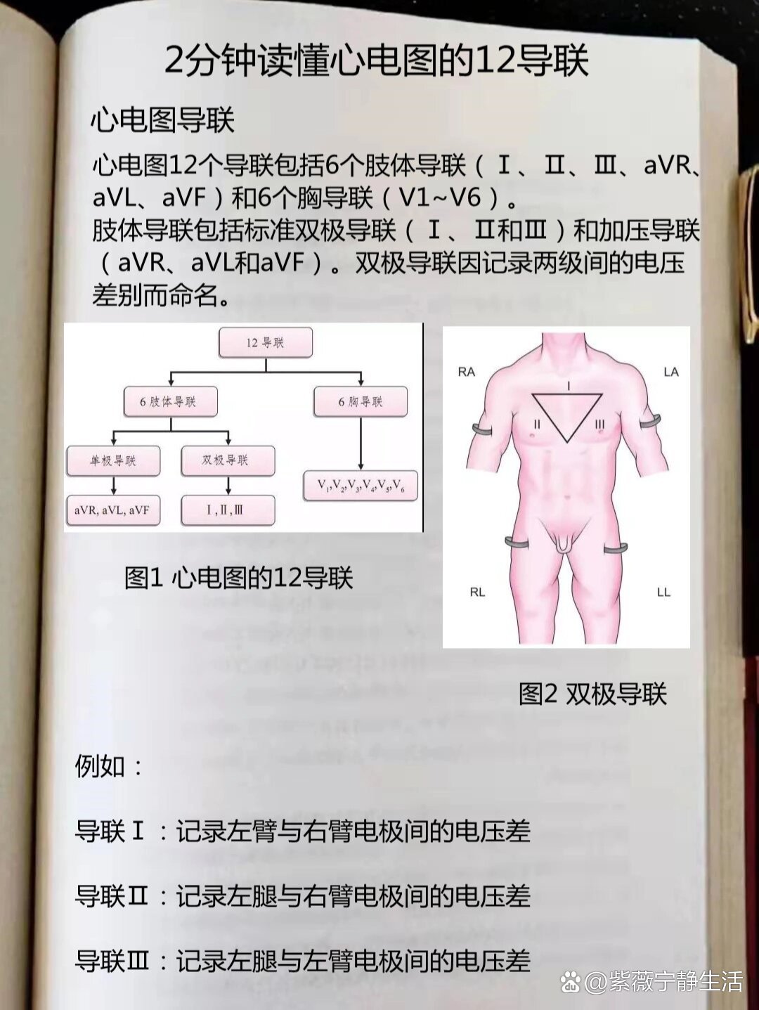 心电图12导联