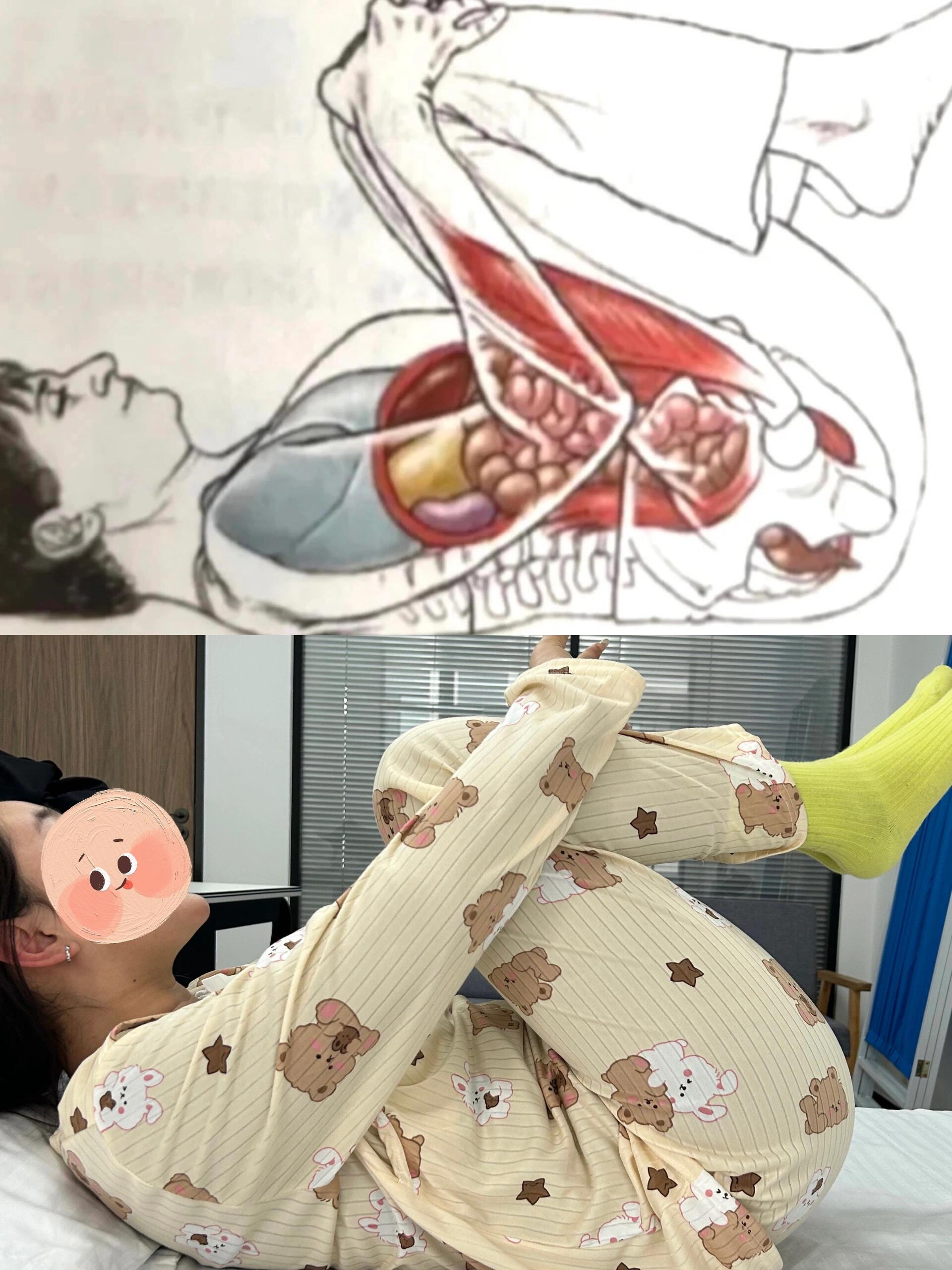 真心建议有痔疮肉球的姐妹们码住!