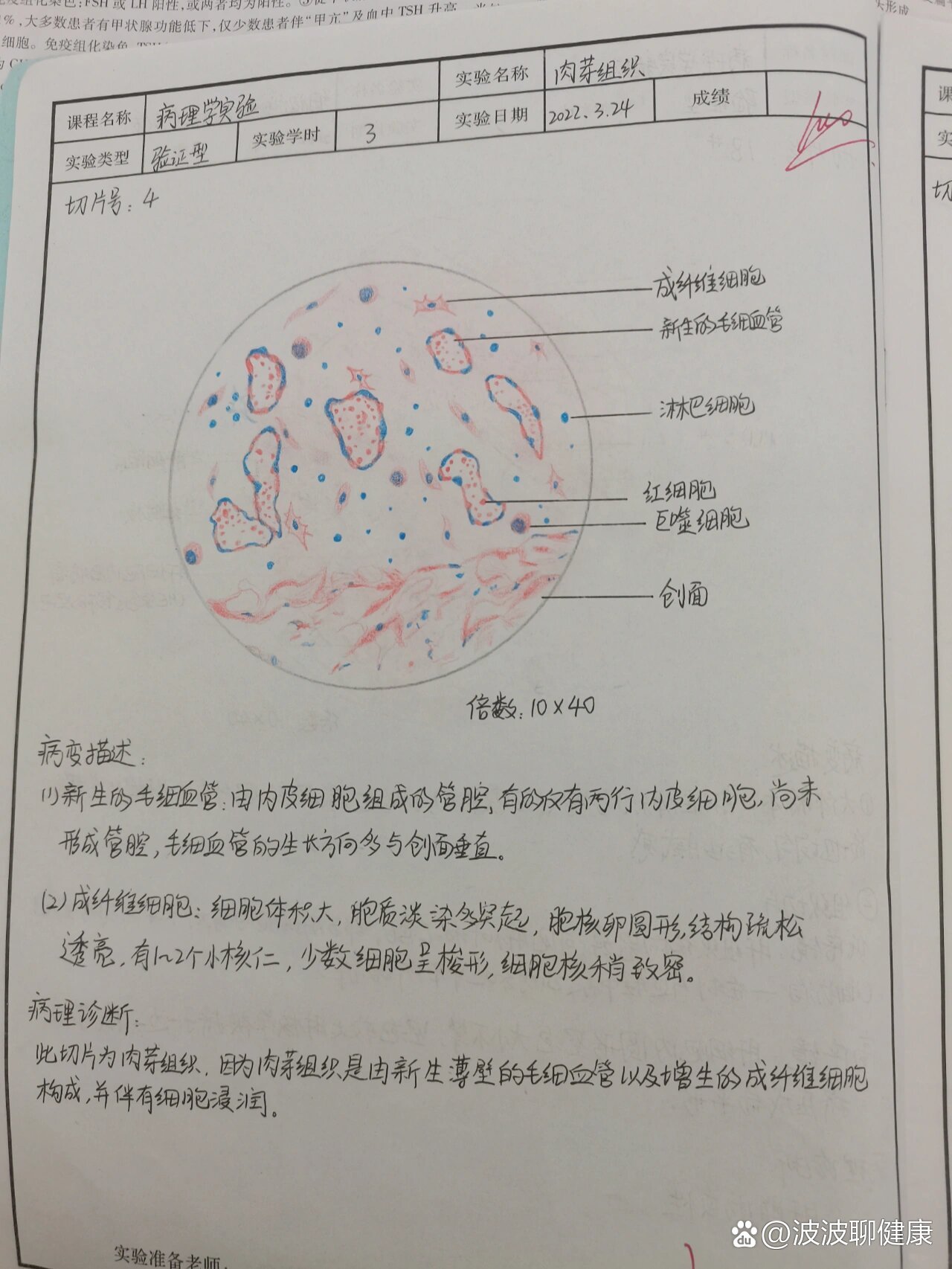 心壁切片手绘图图片