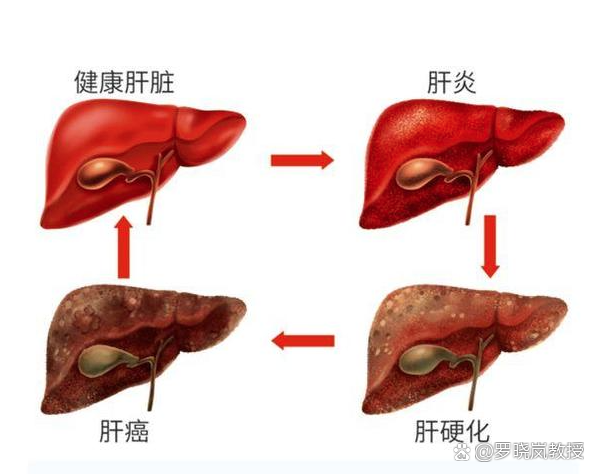 肝包膜图示图片