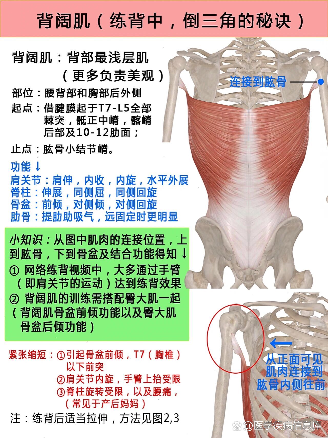 阔背肌疼痛图片