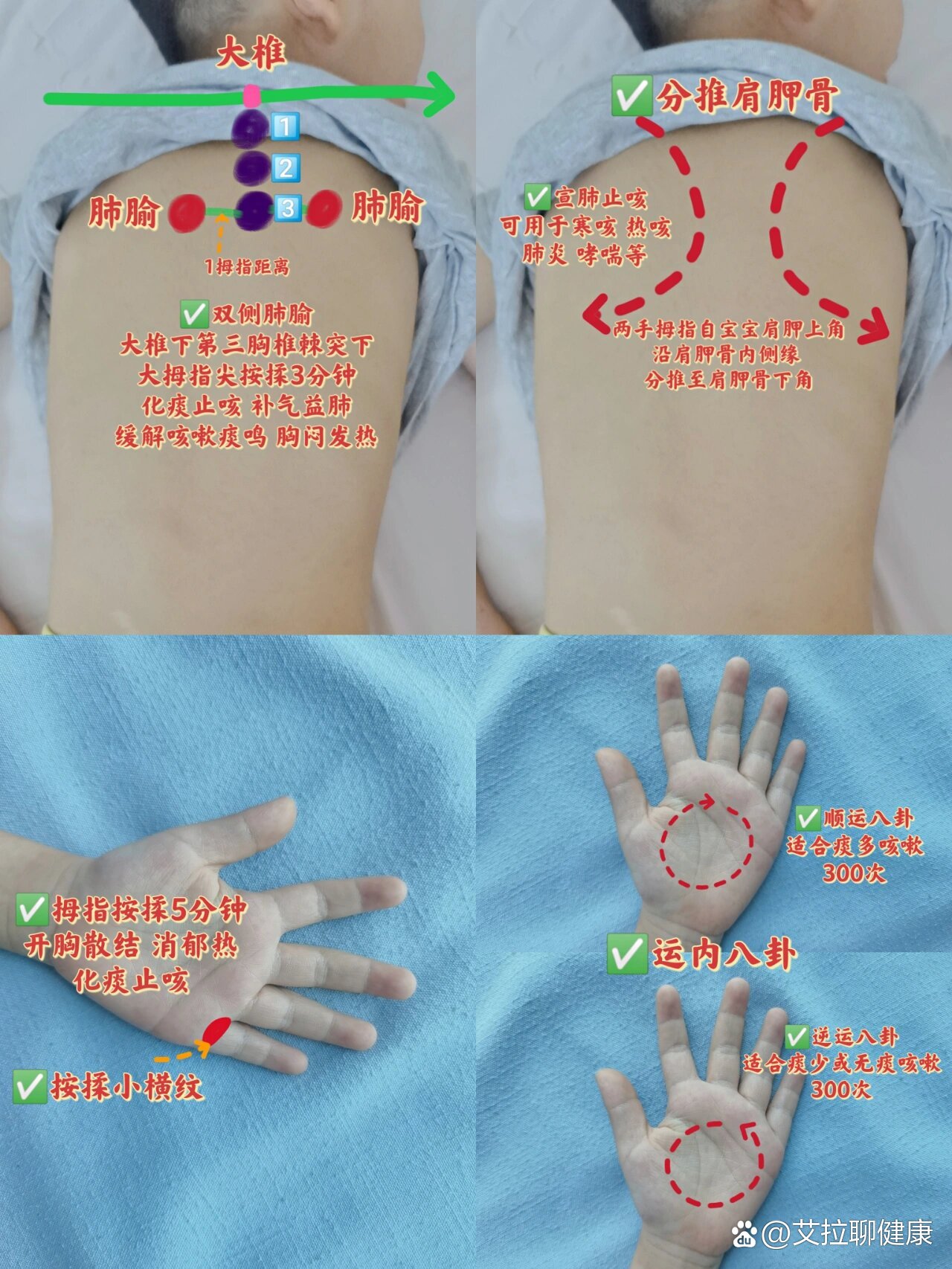小儿咳嗽喘息宝藏穴位图解,妈妈们收藏吧75