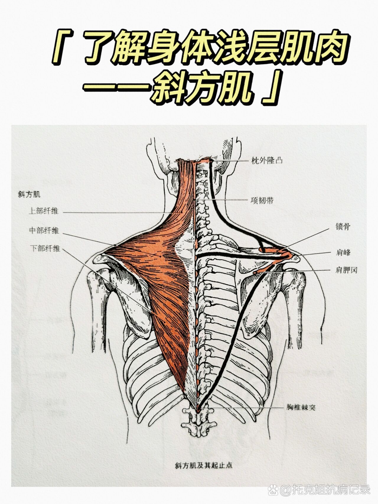 斜方肌肌肉结节图片