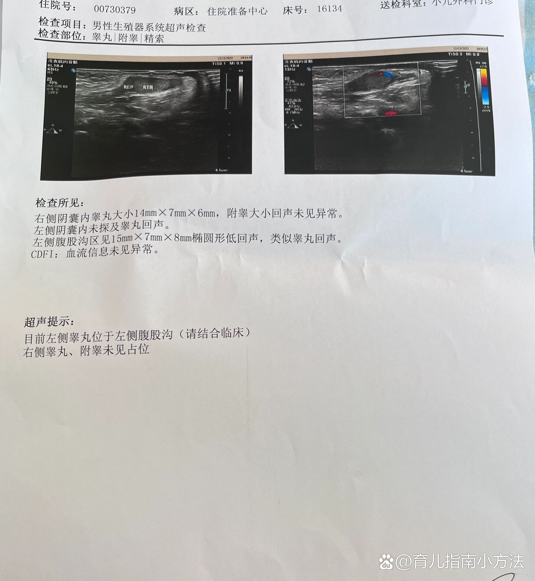 男宝宝隐睾手术什么时候做?