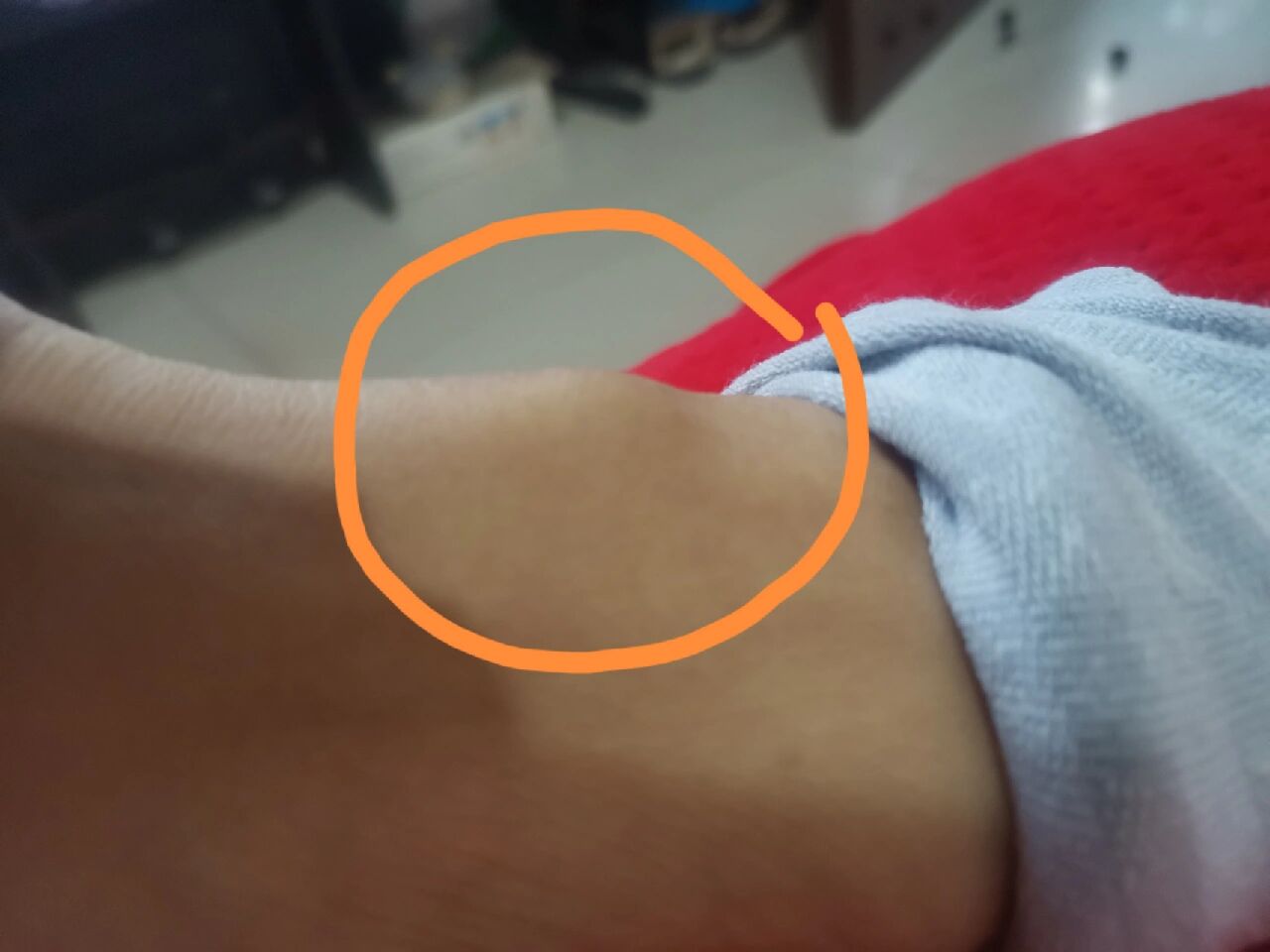 脚背上长了个硬包,有两年了,这是啥,怕怕