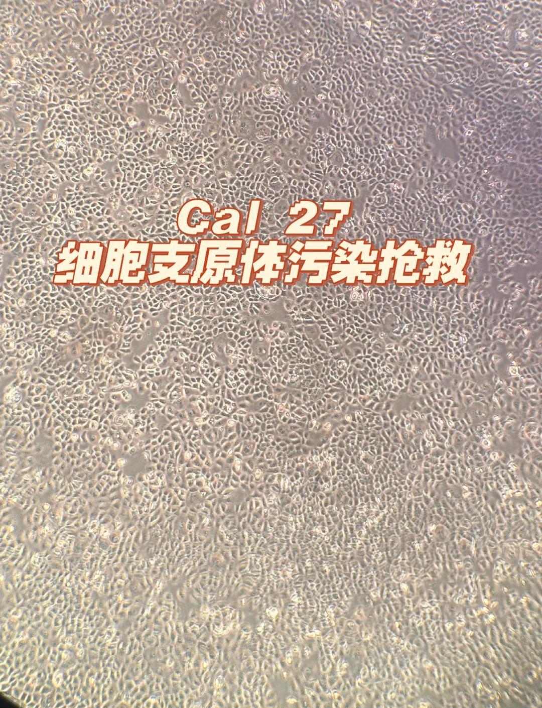 🔬Cal27细胞支原体污染拯救秘籍💉