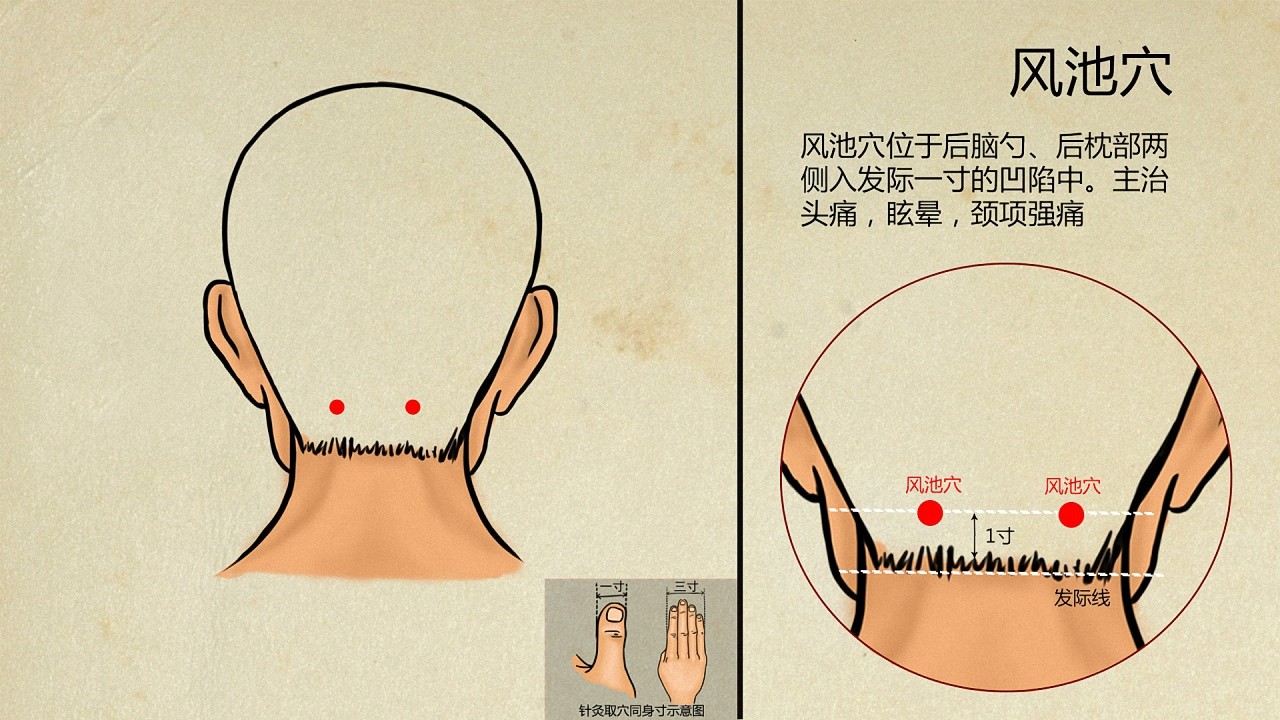 什么是风池穴