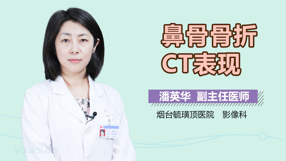 鼻骨骨折ct表现